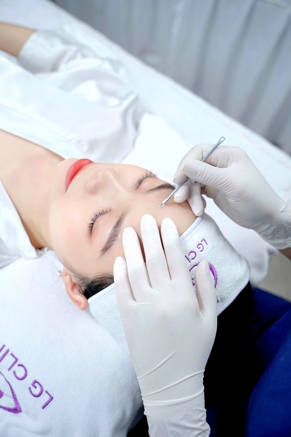 dịch vụ trị mụn