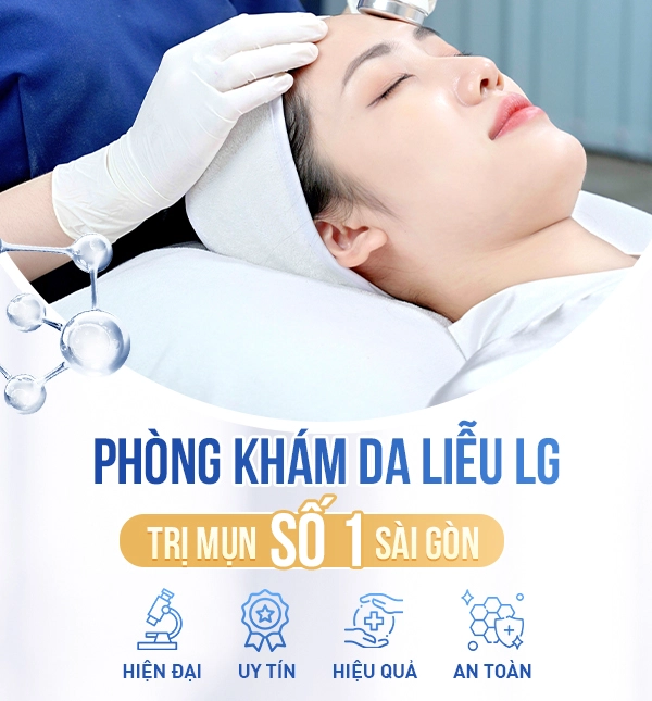 banner phòng khám da liễu lg