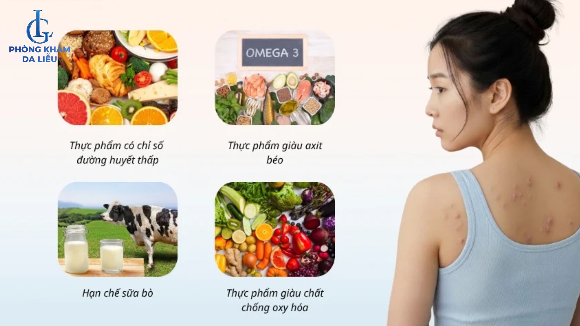 điều trị mụn lưng