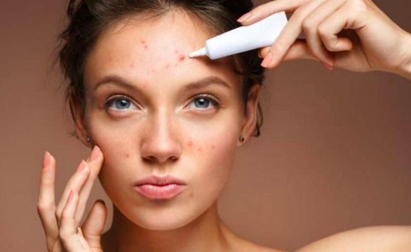 bôi thuốc trị mụn viêm đỏ