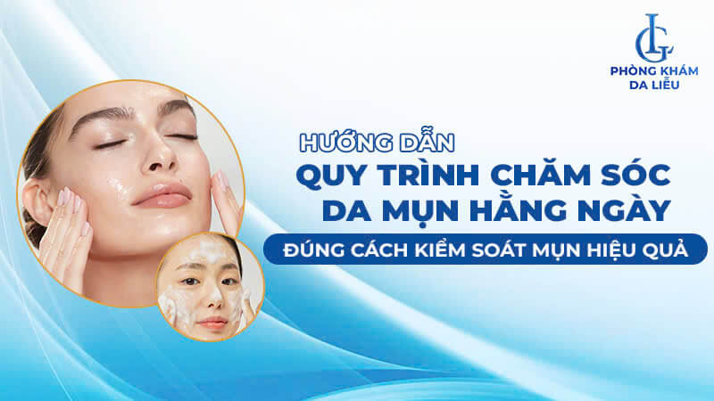 Quy trình chăm sóc da mụn