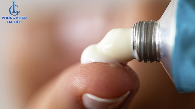 điều trị mụn lưng