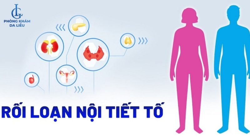 nguyên nhân gây mụn lưng