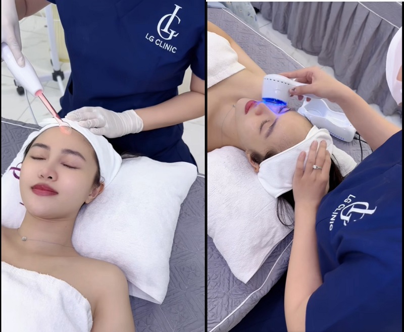 trị mụn viêm bằng công nghệ cao