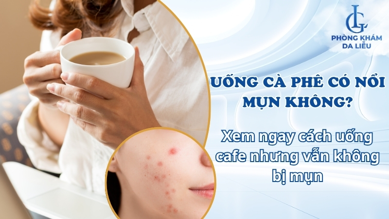 uống cà phê có nổi mụn không