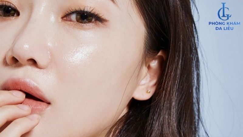 Da sạch mụn sau khi uống isotretinoin