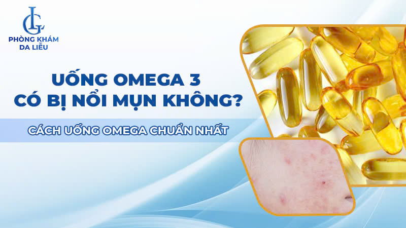 Uống omega 3 có bị nổi mụn không
