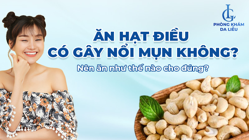 Ăn hạt điều có nổi mụn không