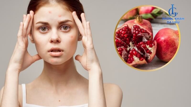 Ăn lựu có nổi mụn không?