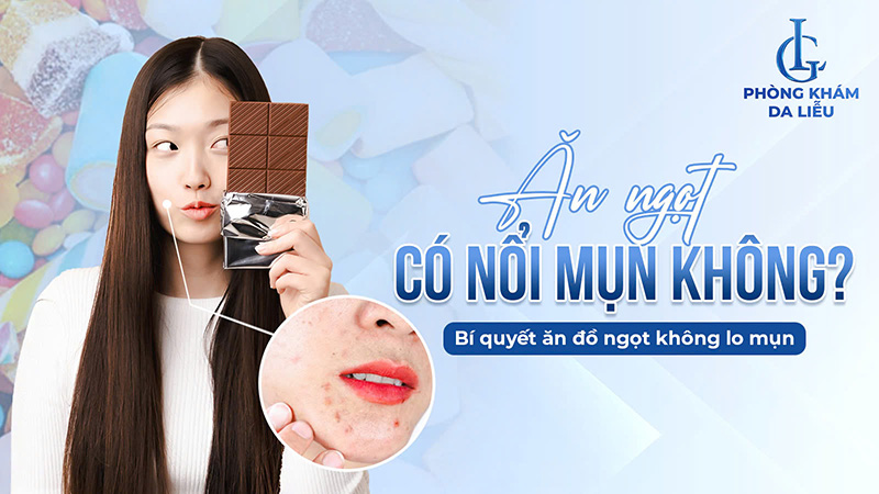 Ăn ngọt có nổi mụn không