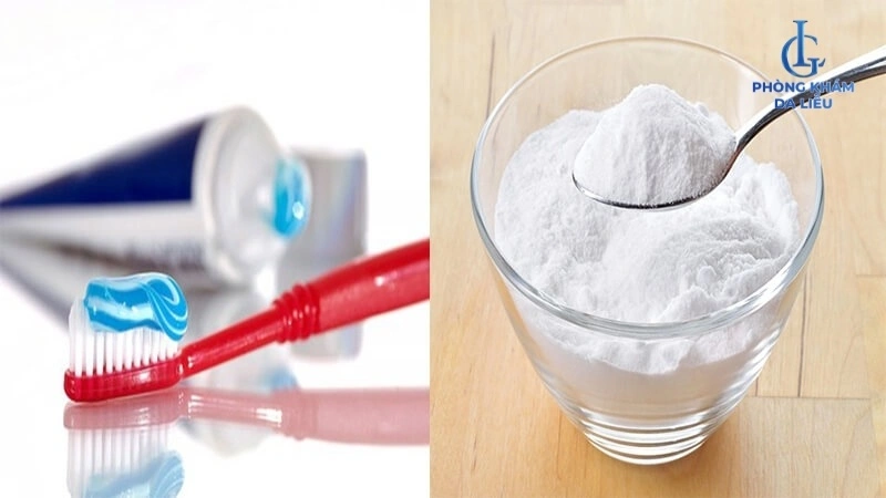Baking soda và kem đánh răng