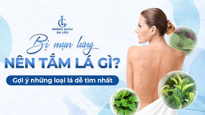 Bị mụn lưng nên tắm lá gì