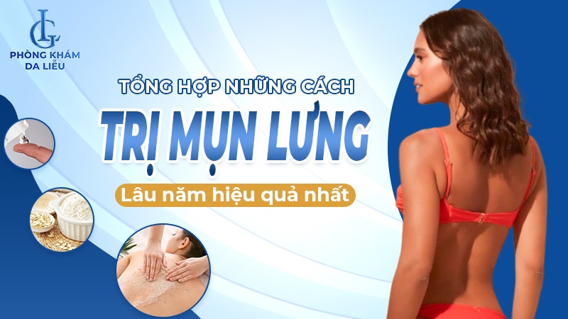 cách trị mụn lưng
