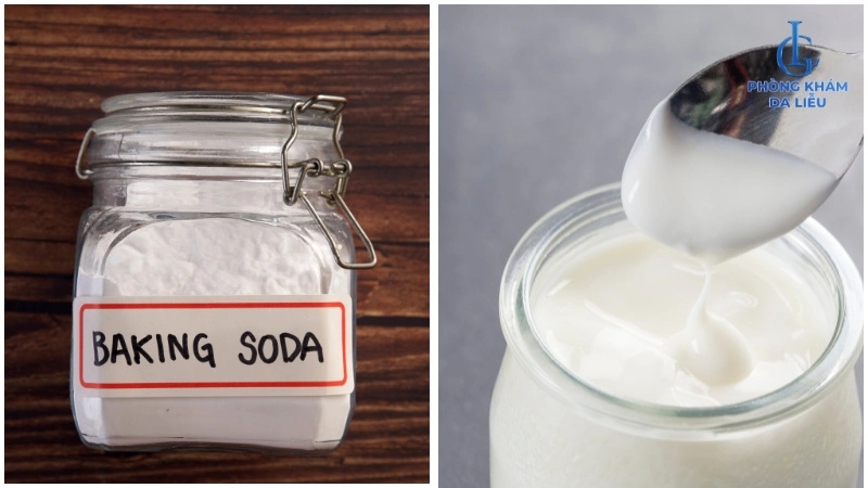 Baking soda và sữa chua