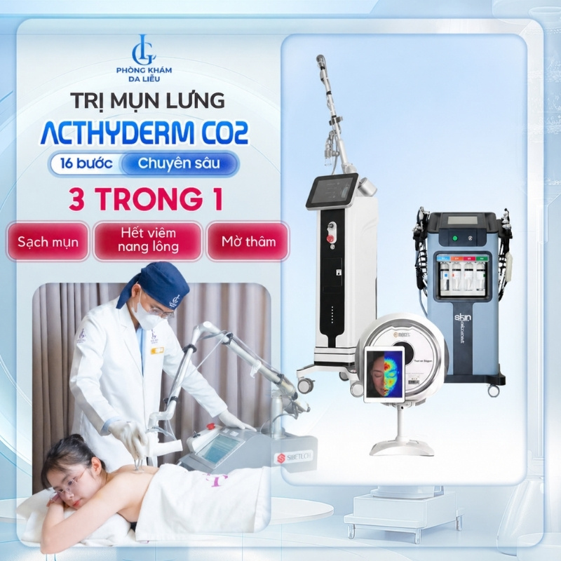 điều trị mụn lưng bằng acthyderm co2