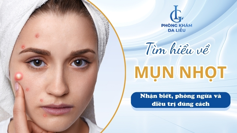 Mụn nhọt