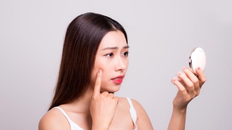làm thế nào để hết mụn trứng cá ở trán