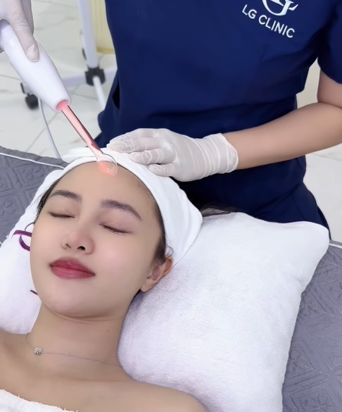 Trị mụn trứng cá ung bằng công nghệ cao