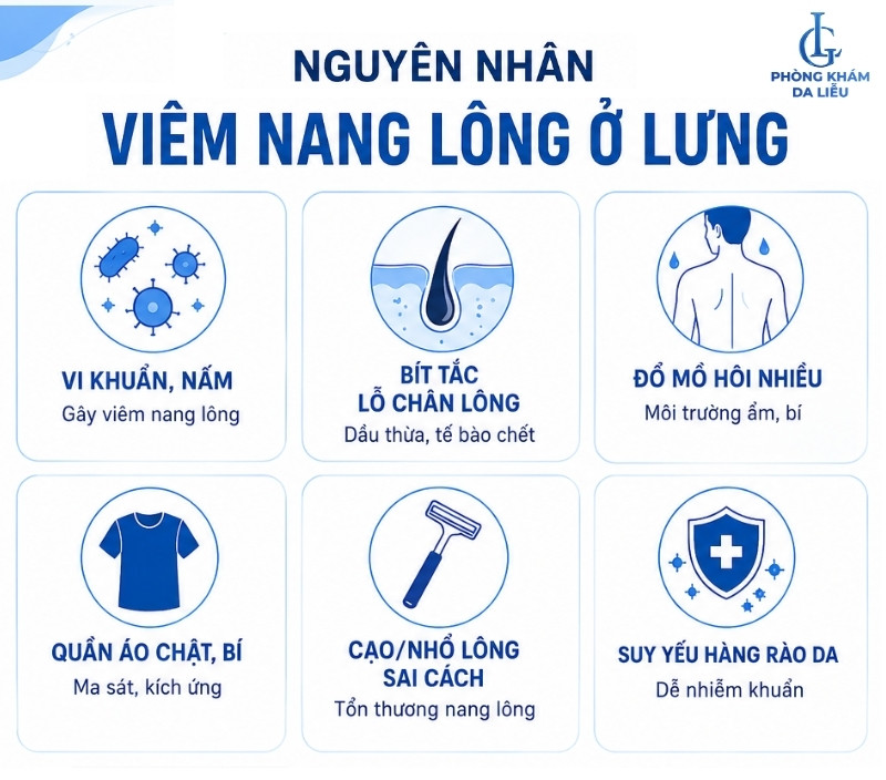 nguyên nhân gây viêm nang lông ở lưng