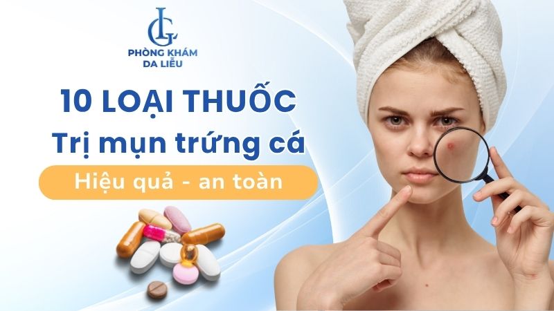 thuốc trị mụn trứng cá