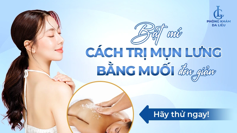 Trị mụn lưng bằng muối
