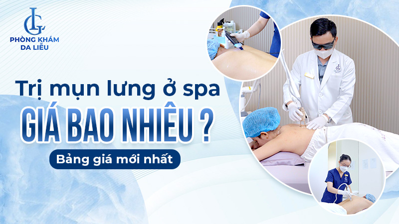 trị mụn lưng ở spa giá bao nhiêu