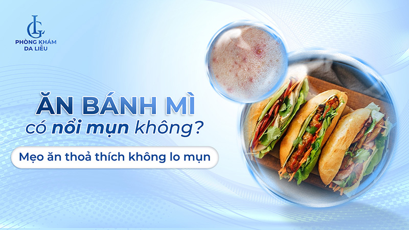 Ăn bánh mì có nổi mụn không