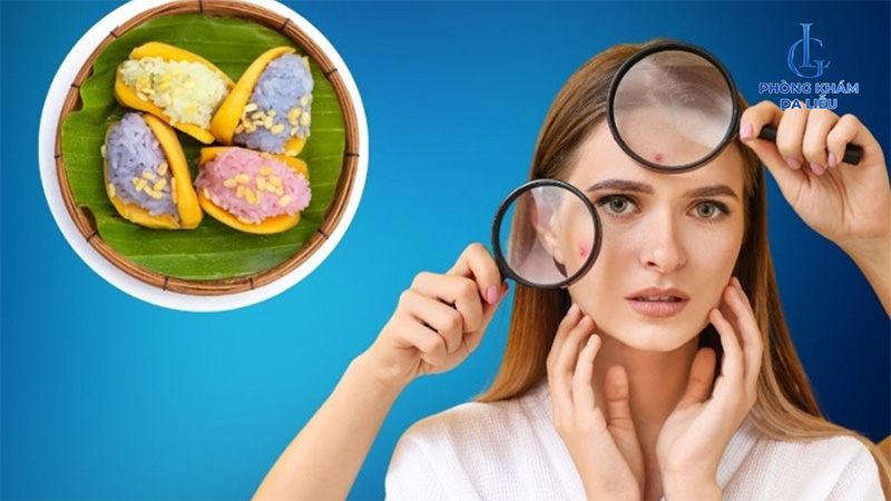 Ăn xôi thường xuyên sẽ gây nóng trong người