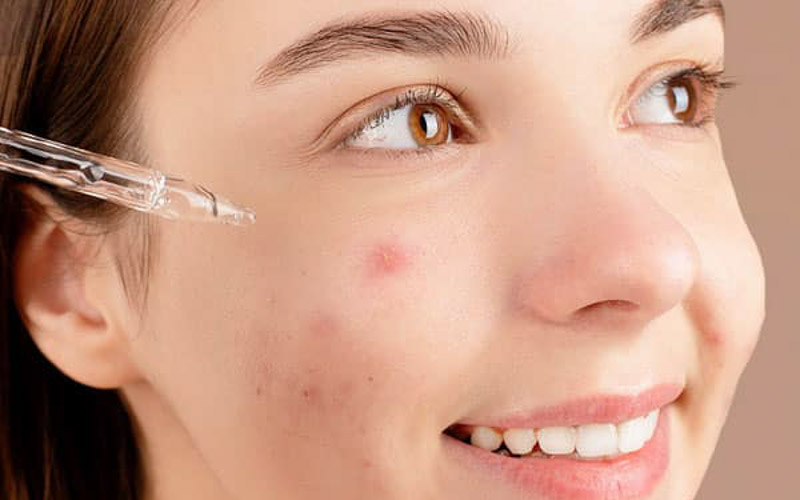thoa serum