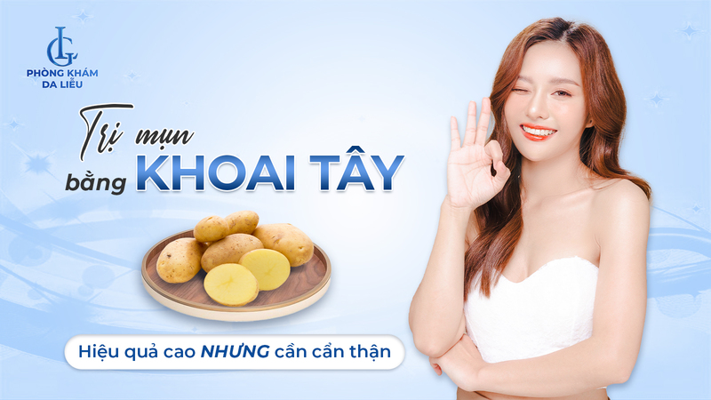 Cách trị mụn bằng khoai tây