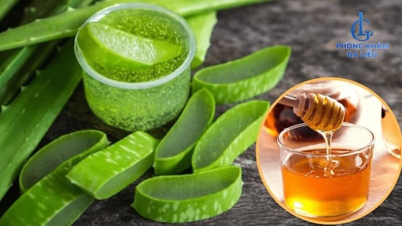 Nha đam và mật ong