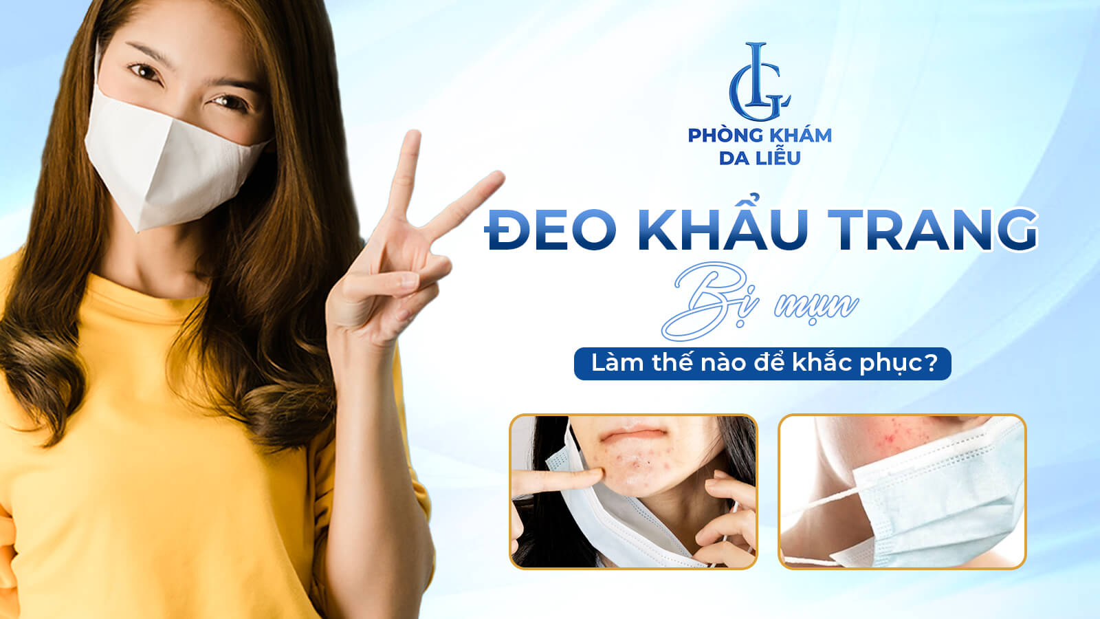 đeo khẩu trang bị mụn