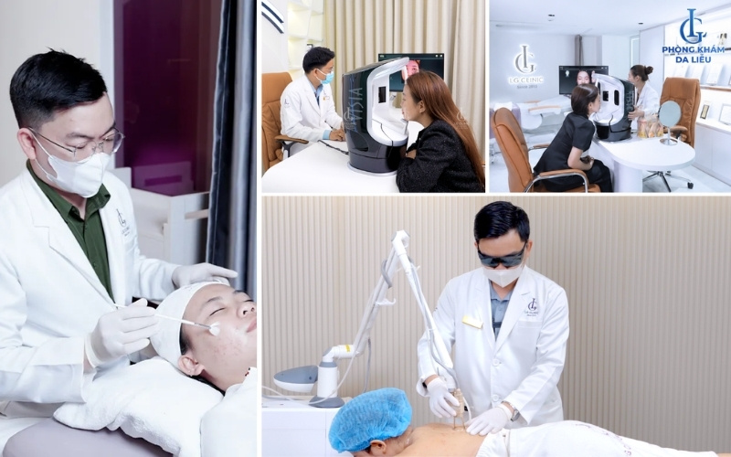 điều trị mụn mặt, mụn lưng, soi da tại lg clinci quận 1