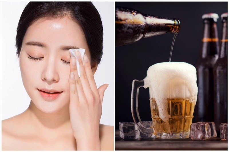 dùng bia trị mụn