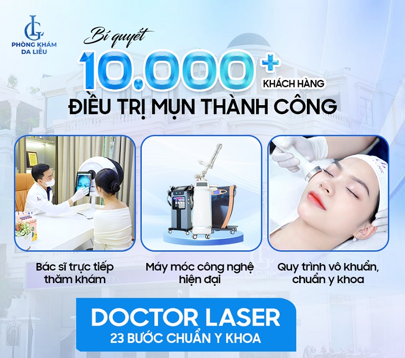 trị mụn tại phòng khám da liễu LG