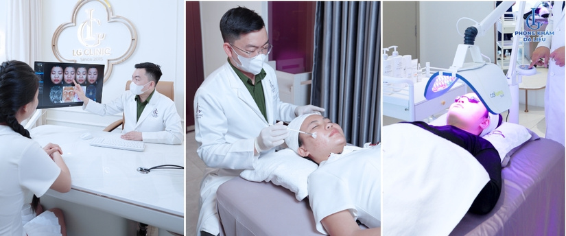 Trị mụn tân phú