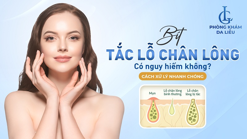tắc lỗ chân lông