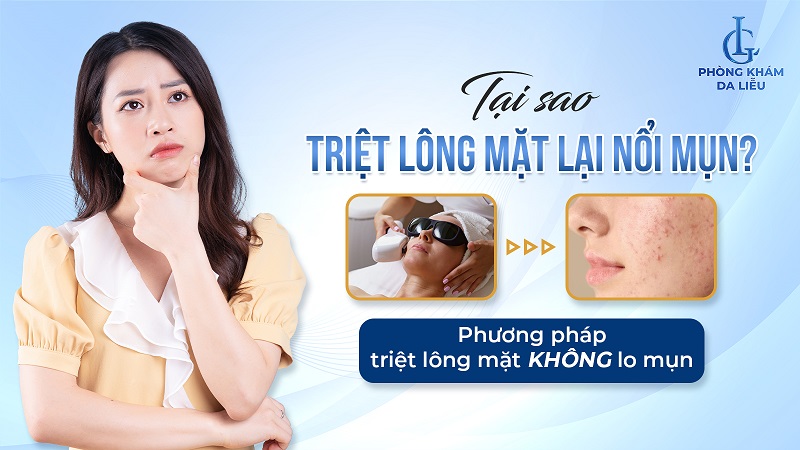 tại sao triệt lông mặt lại nổi mụn​