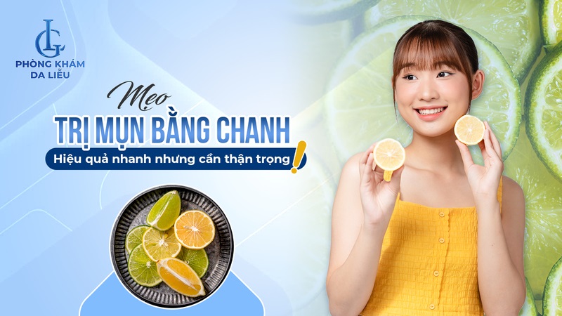 cách trị mụn bằng chanh​