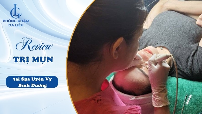 địa chỉ trị mụn Bình Dương Spa Uyên Vy