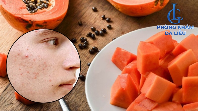 ăn đu đủ nổi mụn