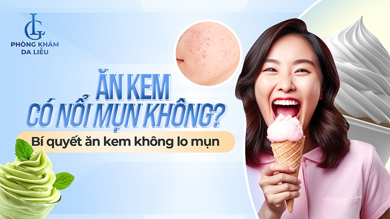 ăn kem có nổi mụn không