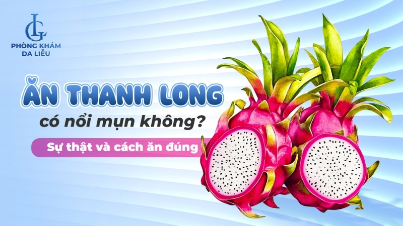 ăn thanh long có nổi mụn không