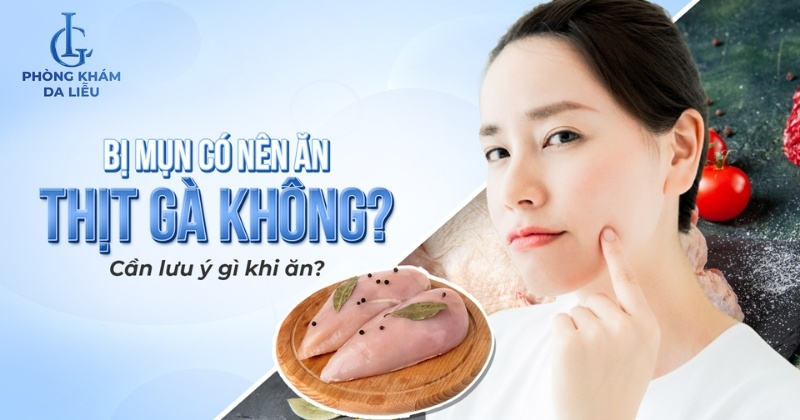 bị mụn có nên ăn thịt gà không