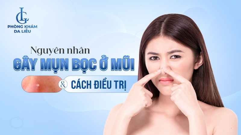 mụn bọc ở mũi