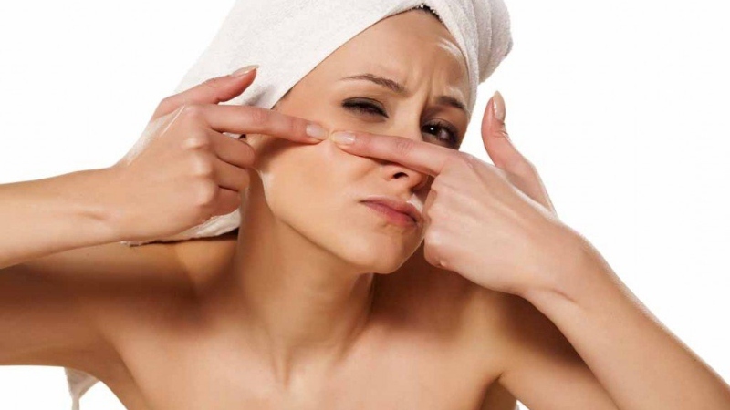 Mụn đầu đen có tự hết không