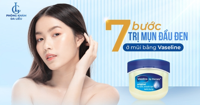 trị mụn đầu đen ở mũi bằng vaseline