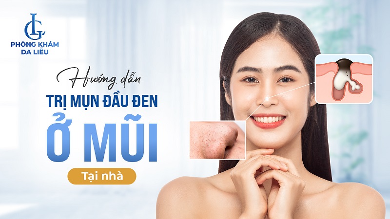 trị mụn đầu đen ở mũi tại nhà