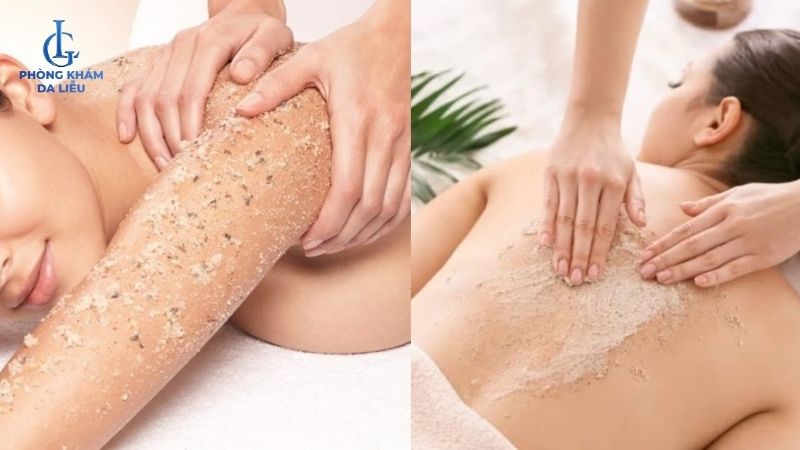 trị mụn ẩn ở lưng