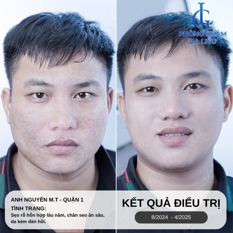 Hiệu quả trị seo rỗ